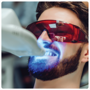 Professional teeth whitening procedure
