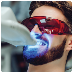 Professional teeth whitening procedure